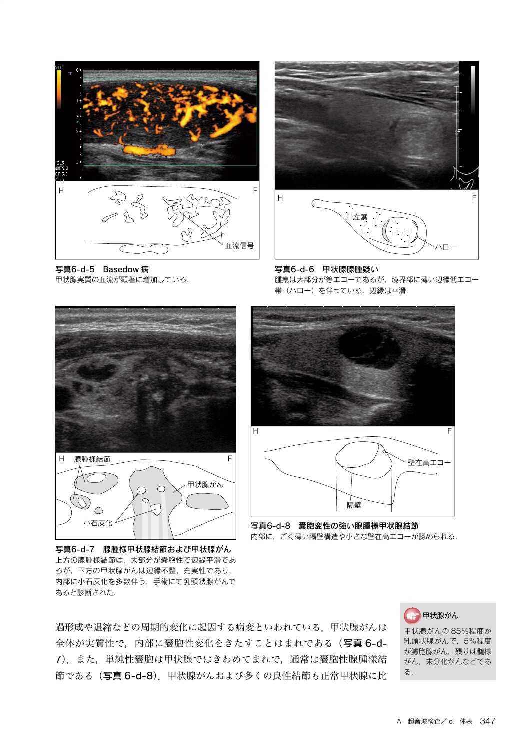 サムネイル画像5