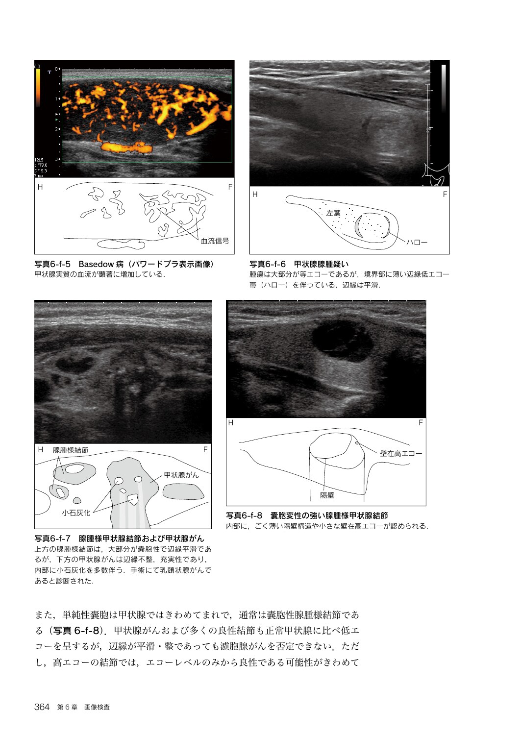 サムネイル画像4