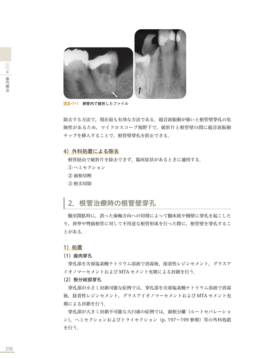 サムネイル画像5