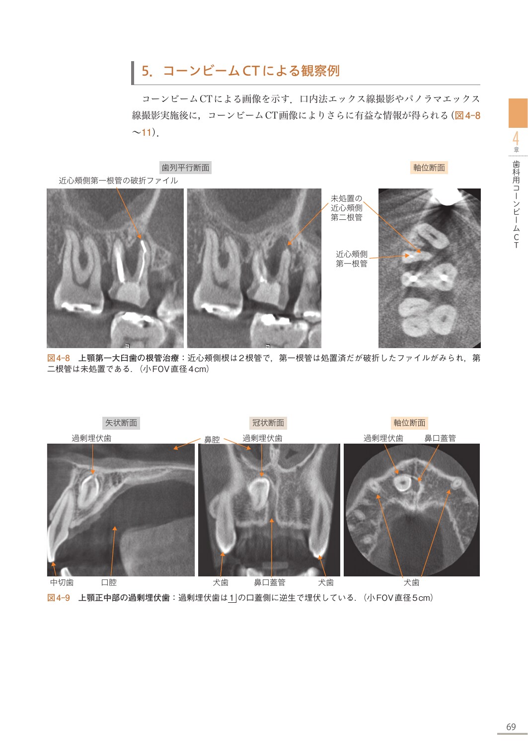 サムネイル画像5