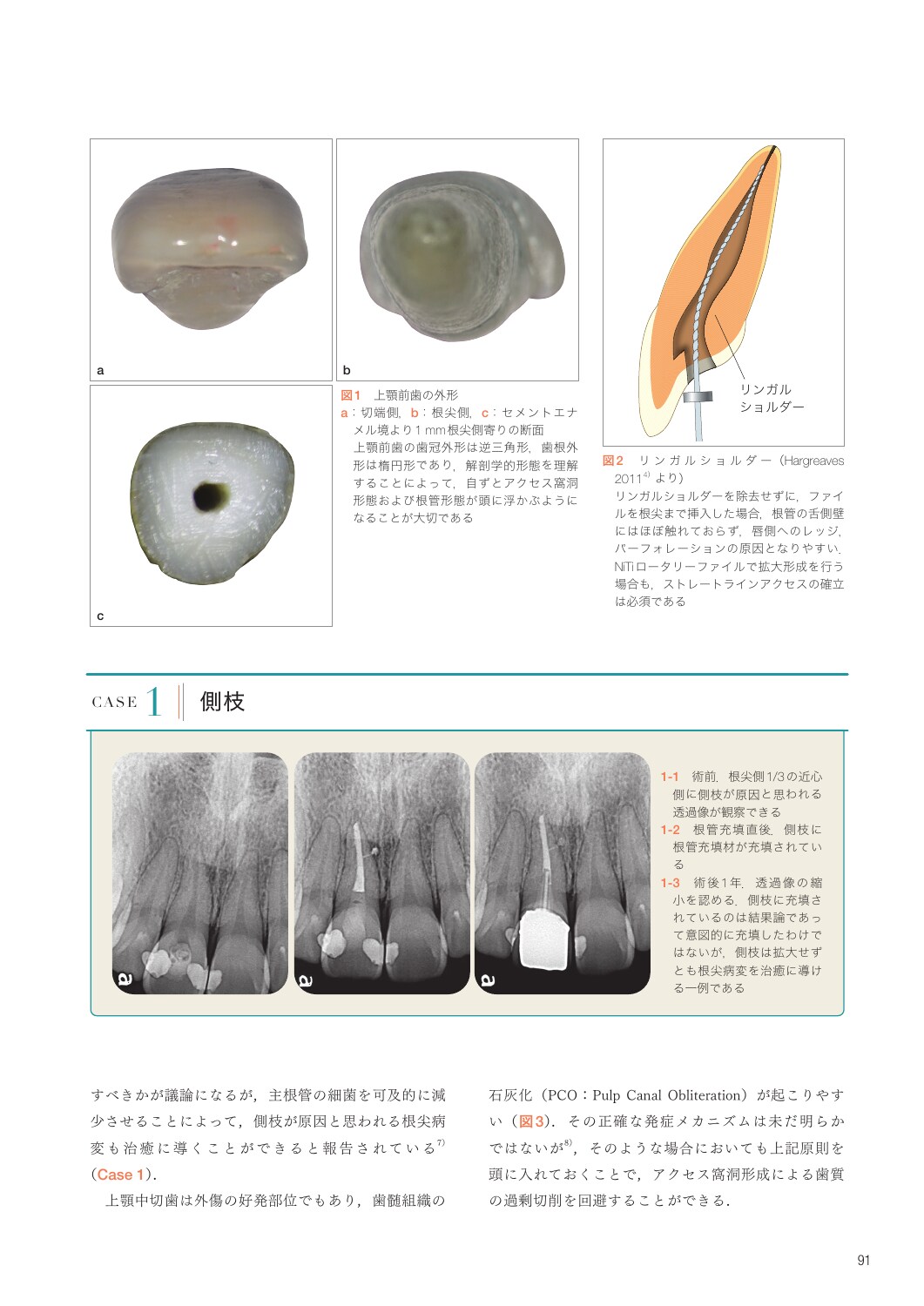 サムネイル画像4