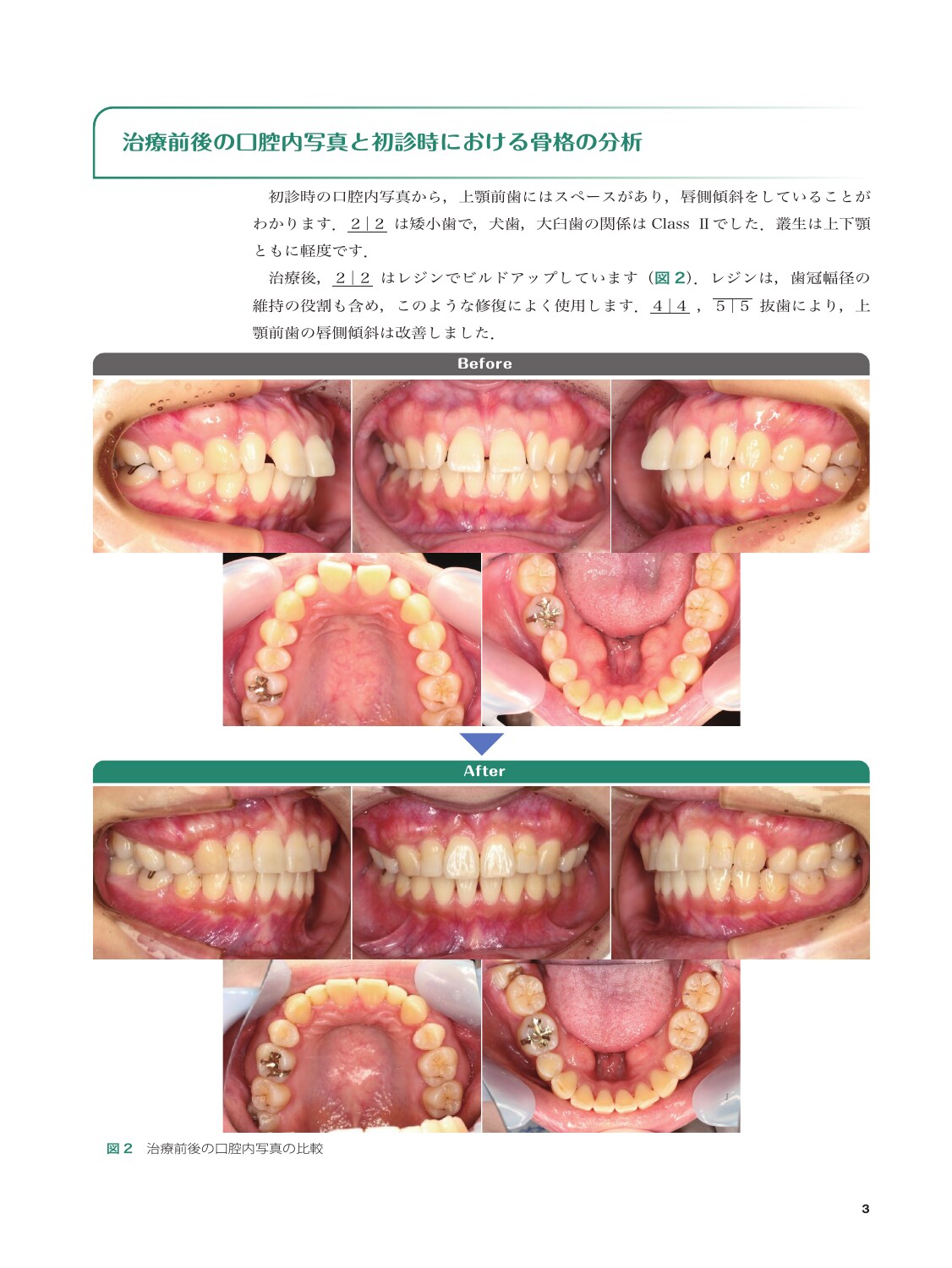 サムネイル画像1