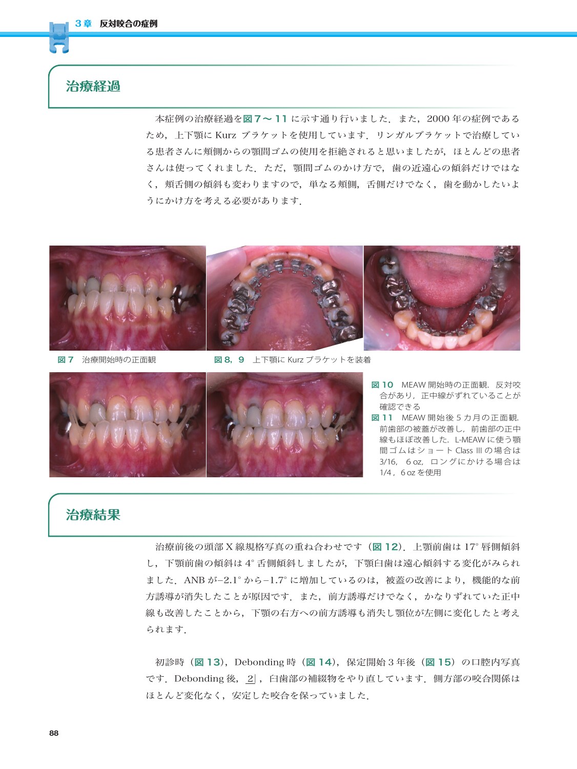 サムネイル画像3