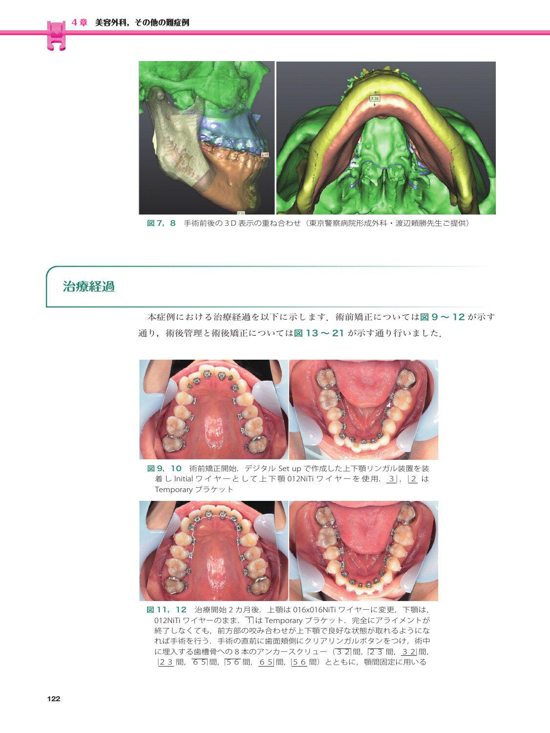 サムネイル画像4