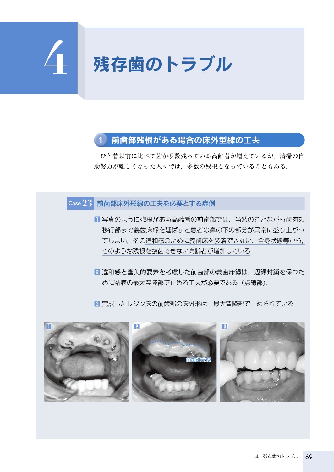サムネイル画像5