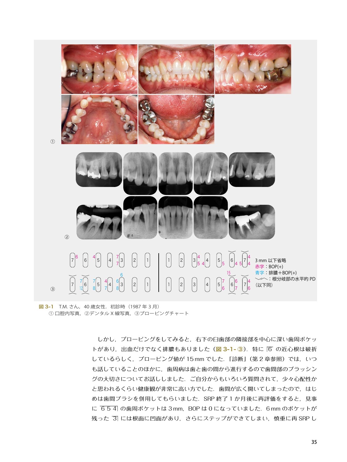 サムネイル画像4