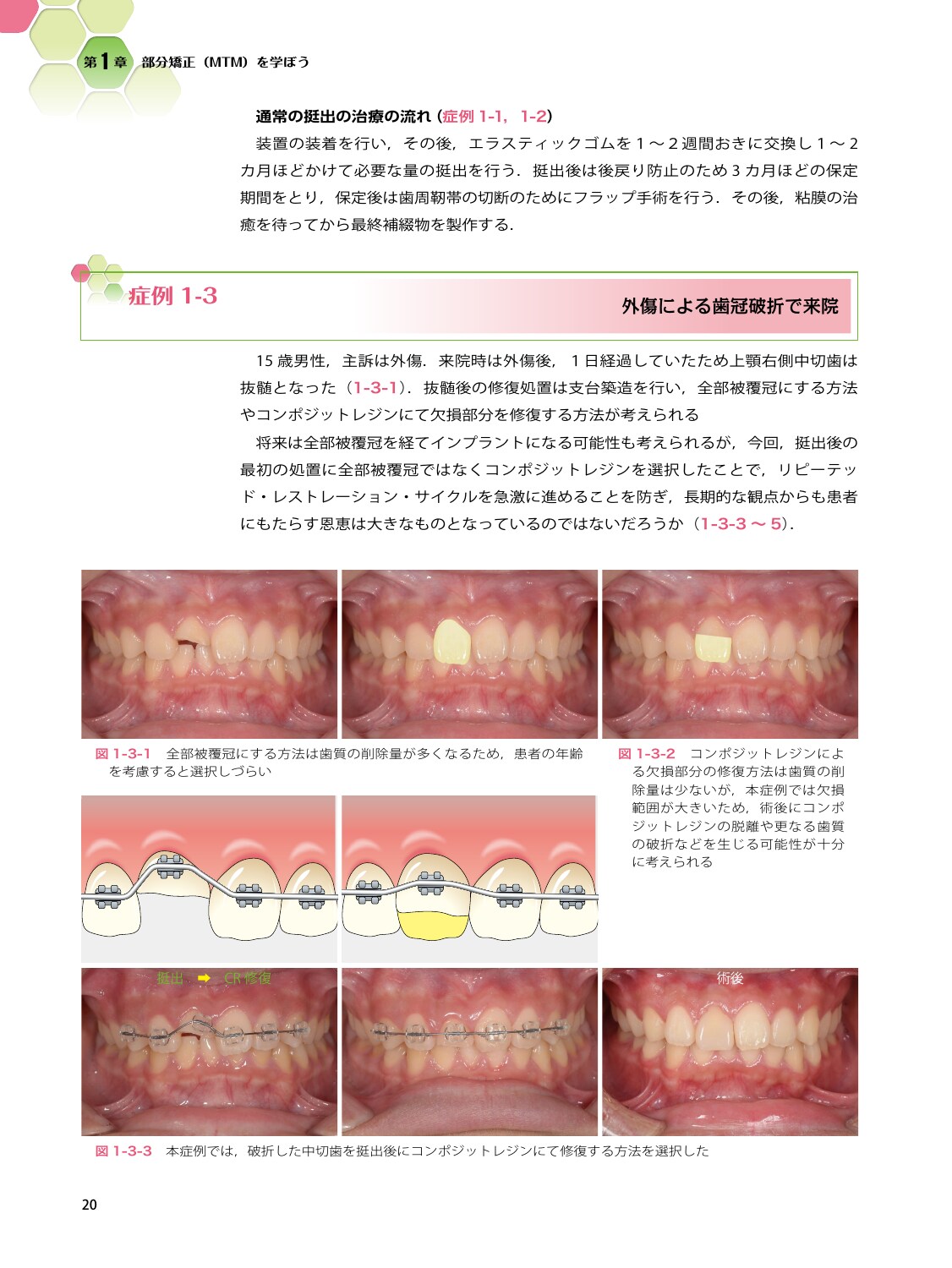 サムネイル画像3
