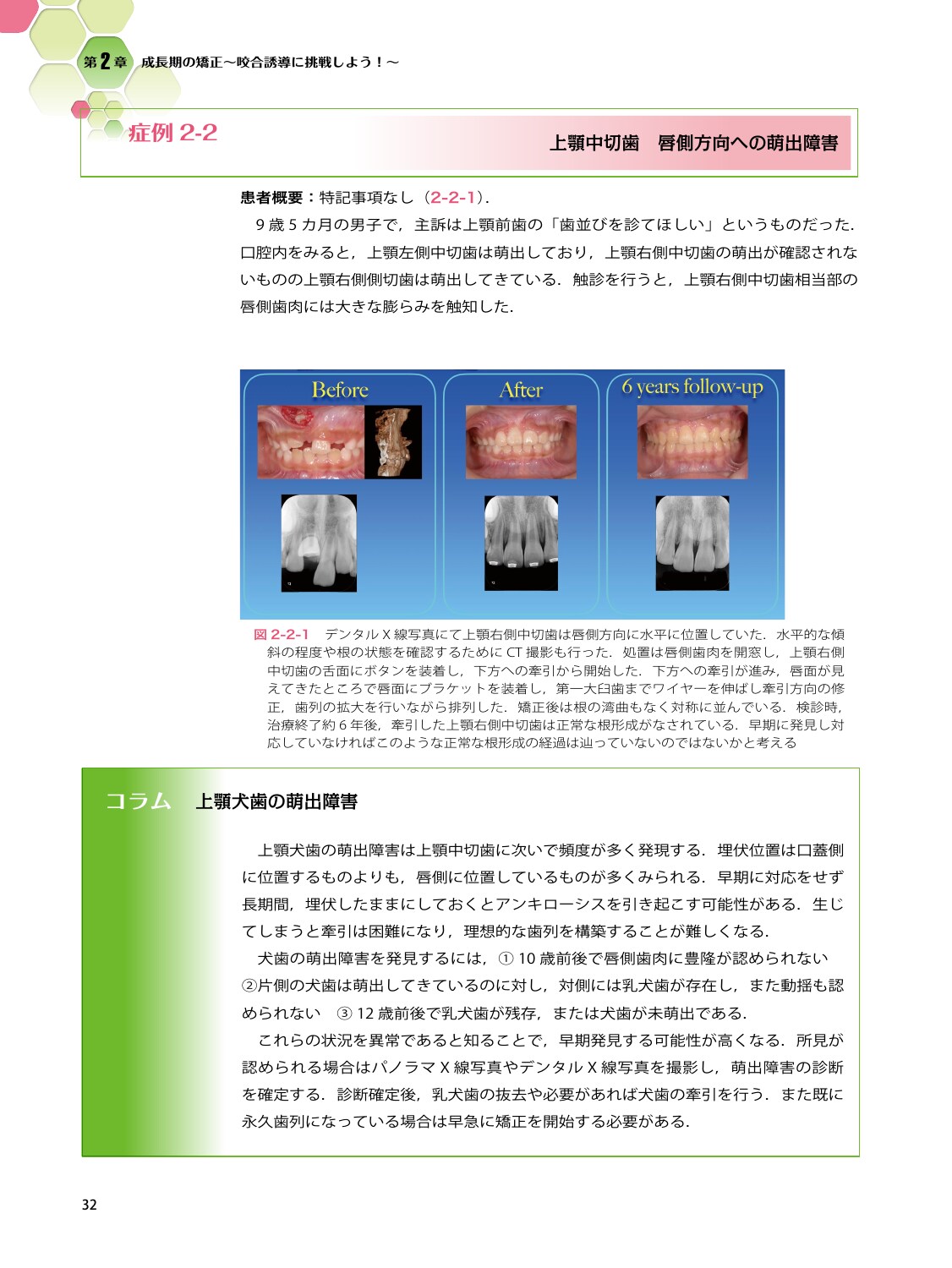 サムネイル画像4