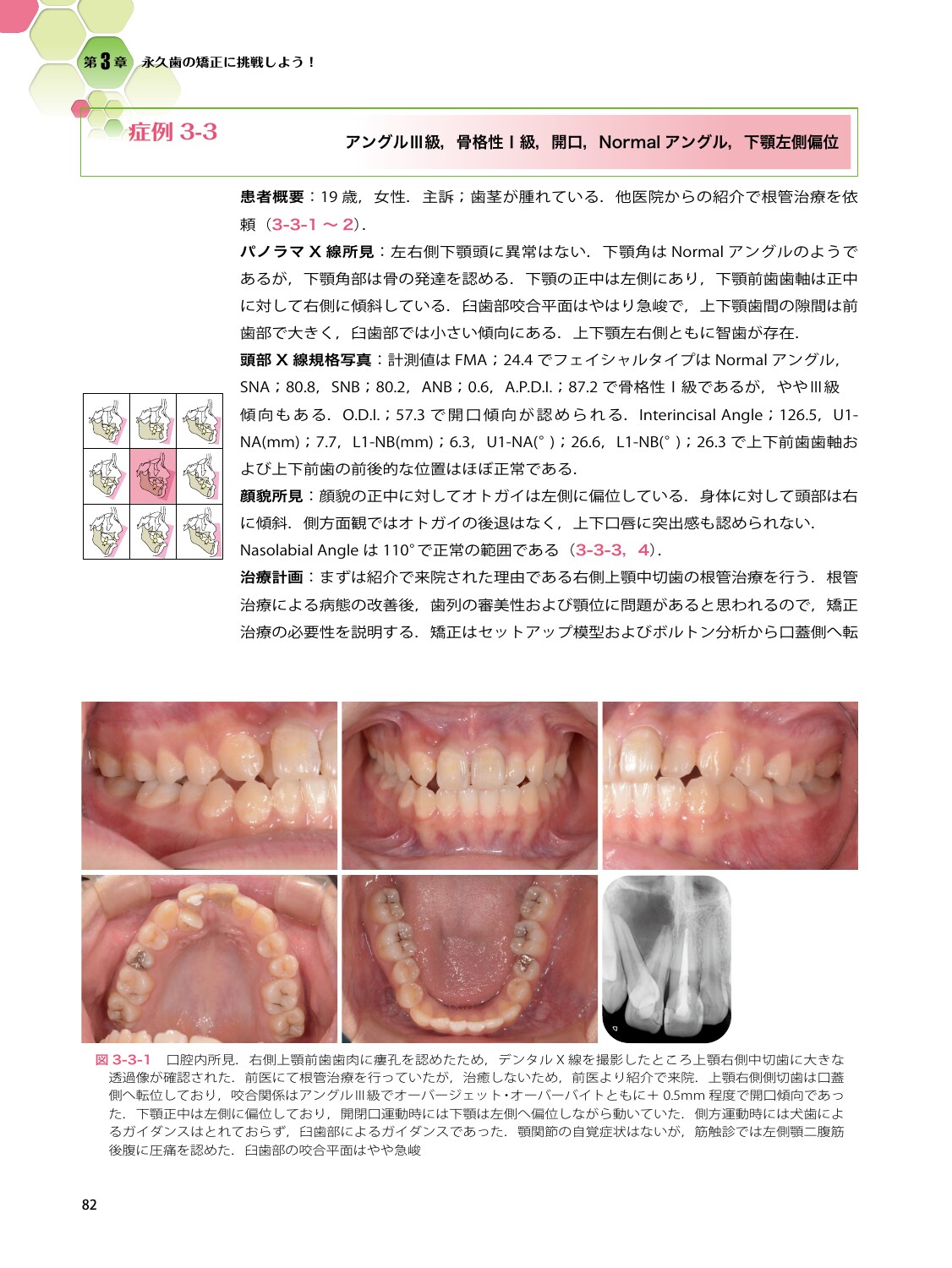 サムネイル画像5