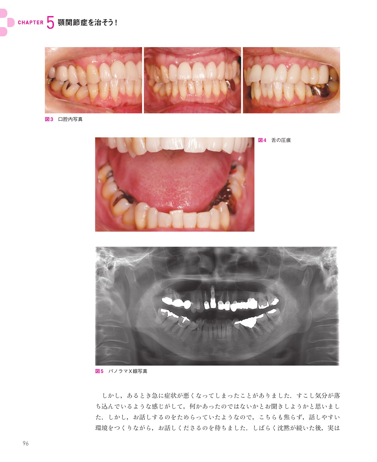 サムネイル画像4