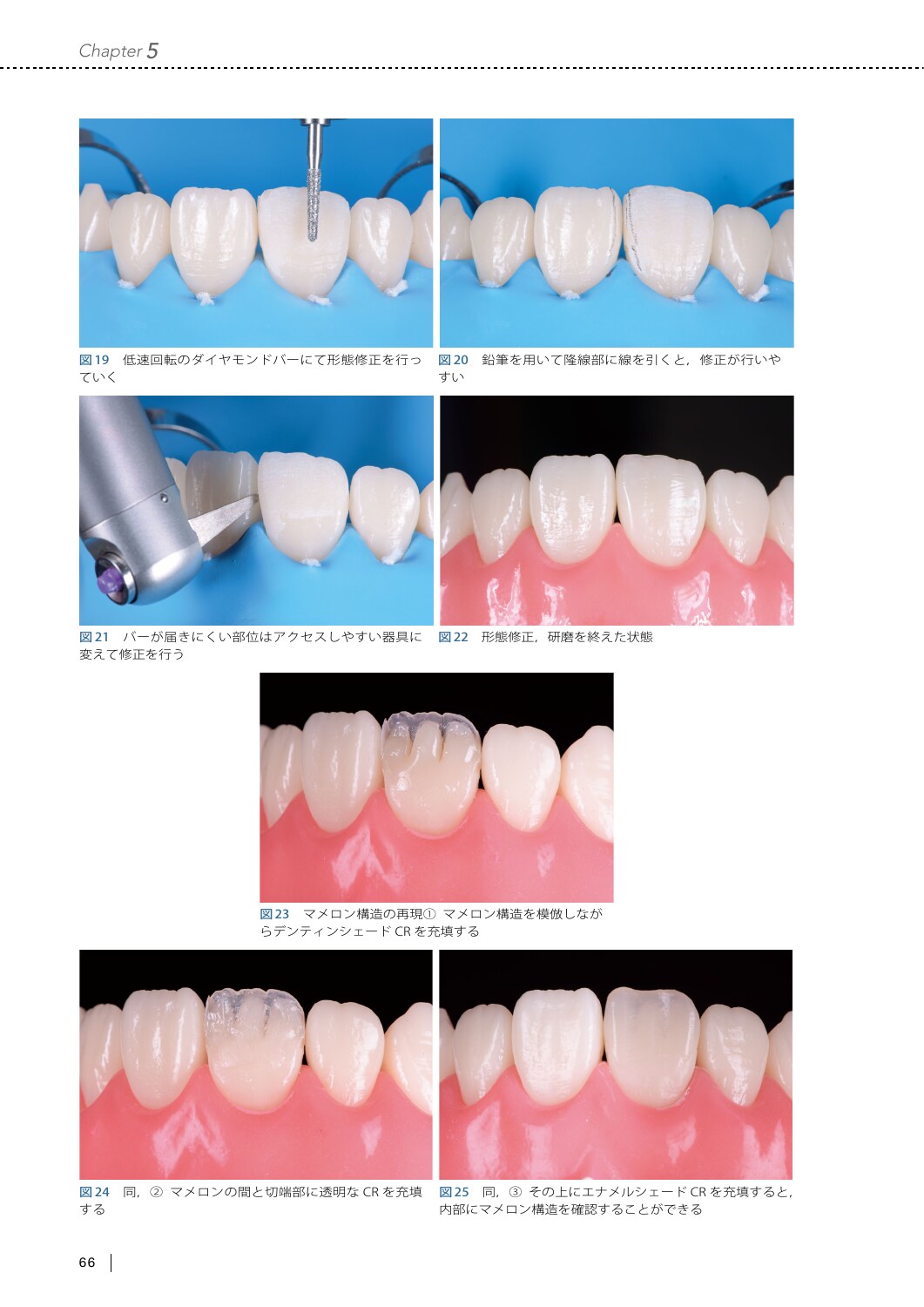 サムネイル画像5