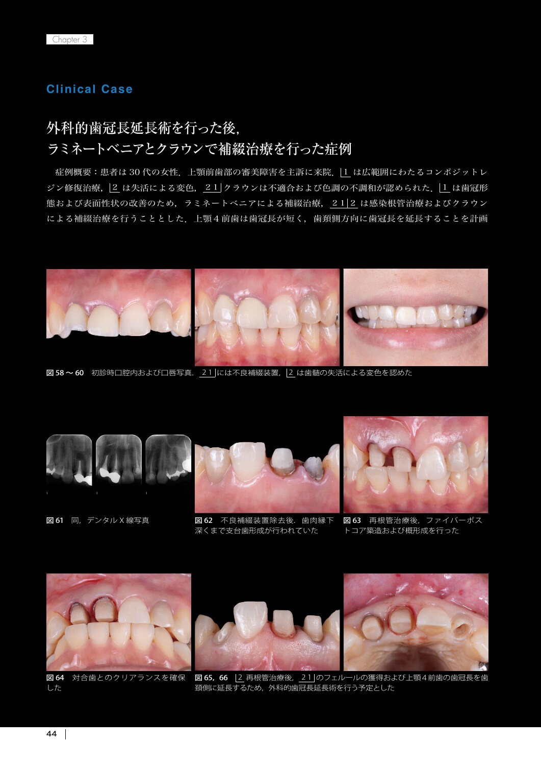 サムネイル画像2