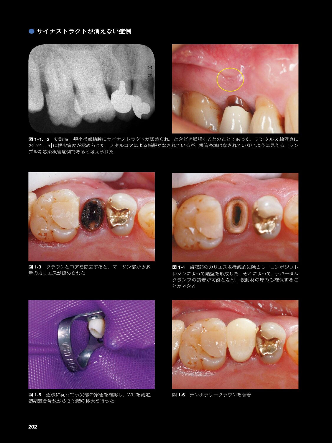 サムネイル画像5