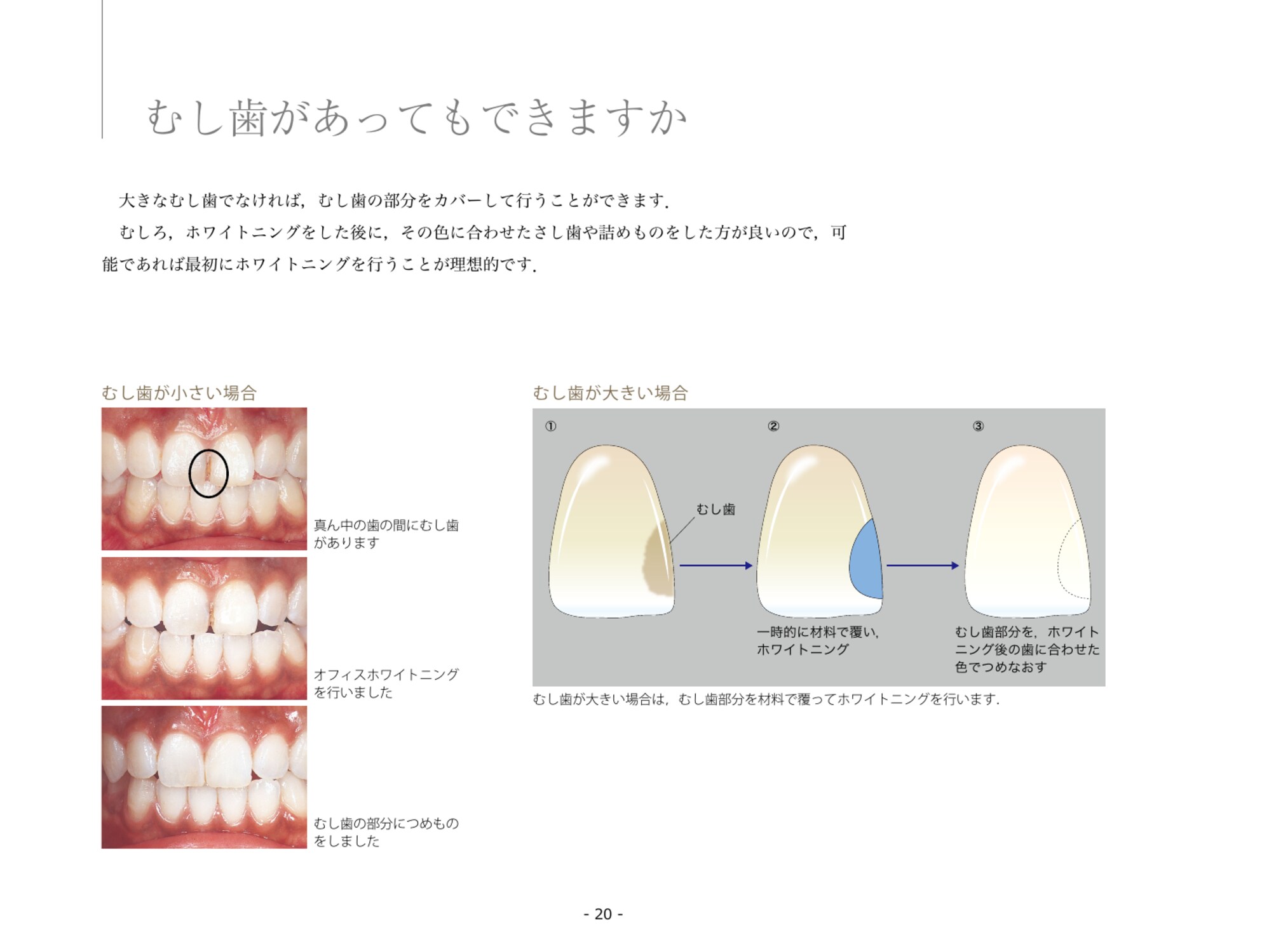 サムネイル画像4