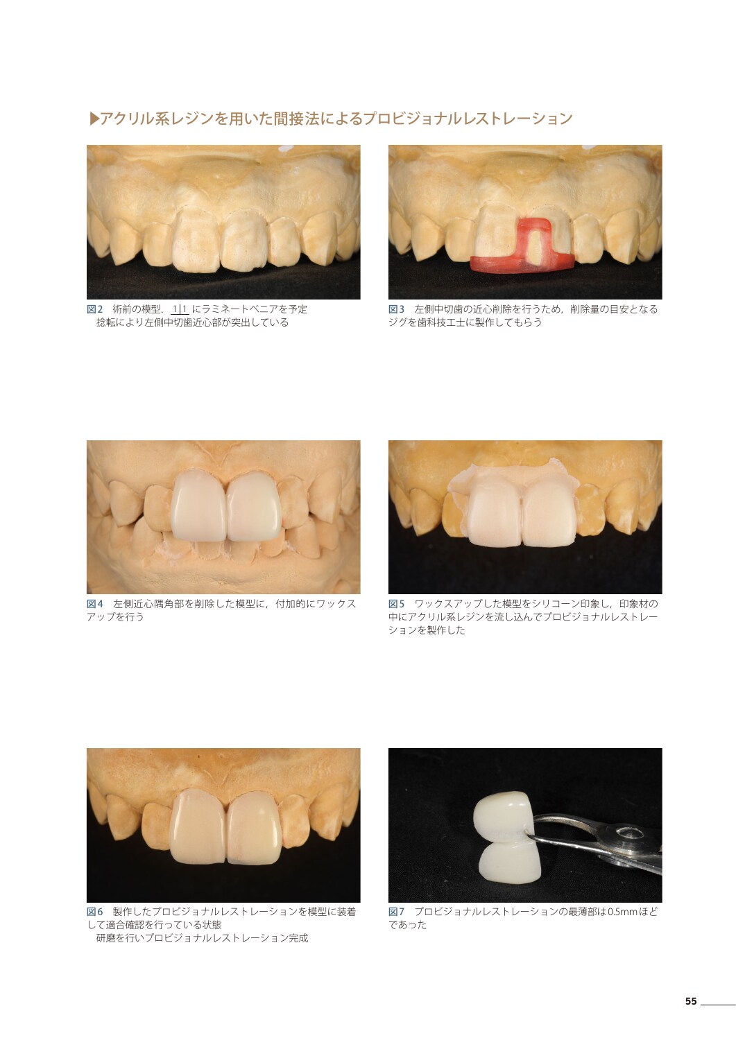 サムネイル画像4