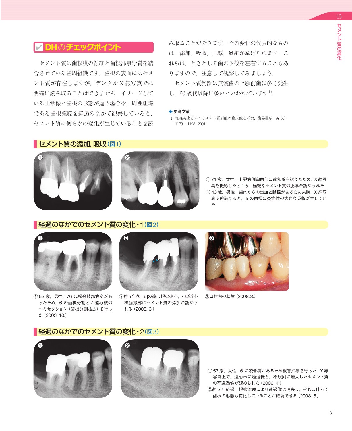 サムネイル画像3