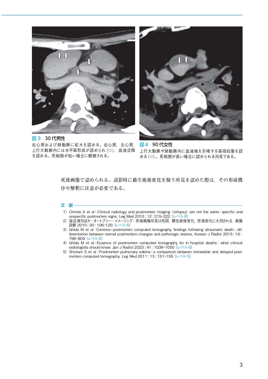 サムネイル画像3