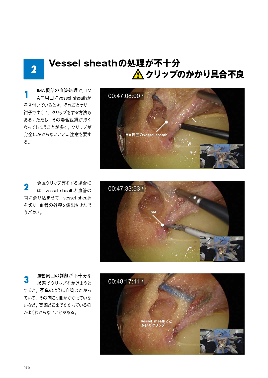 サムネイル画像5