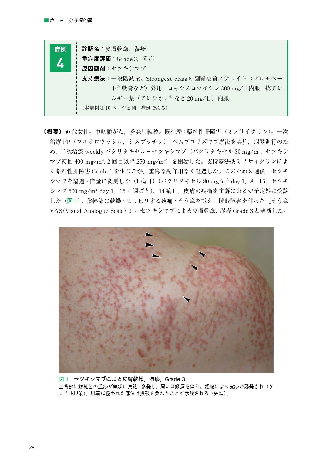 サムネイル画像4