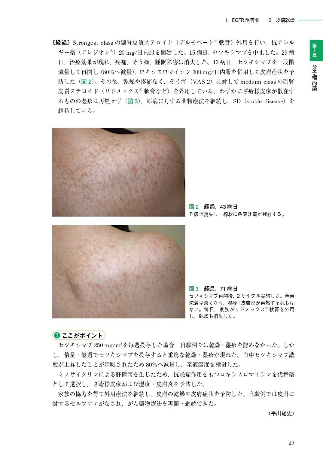 サムネイル画像5