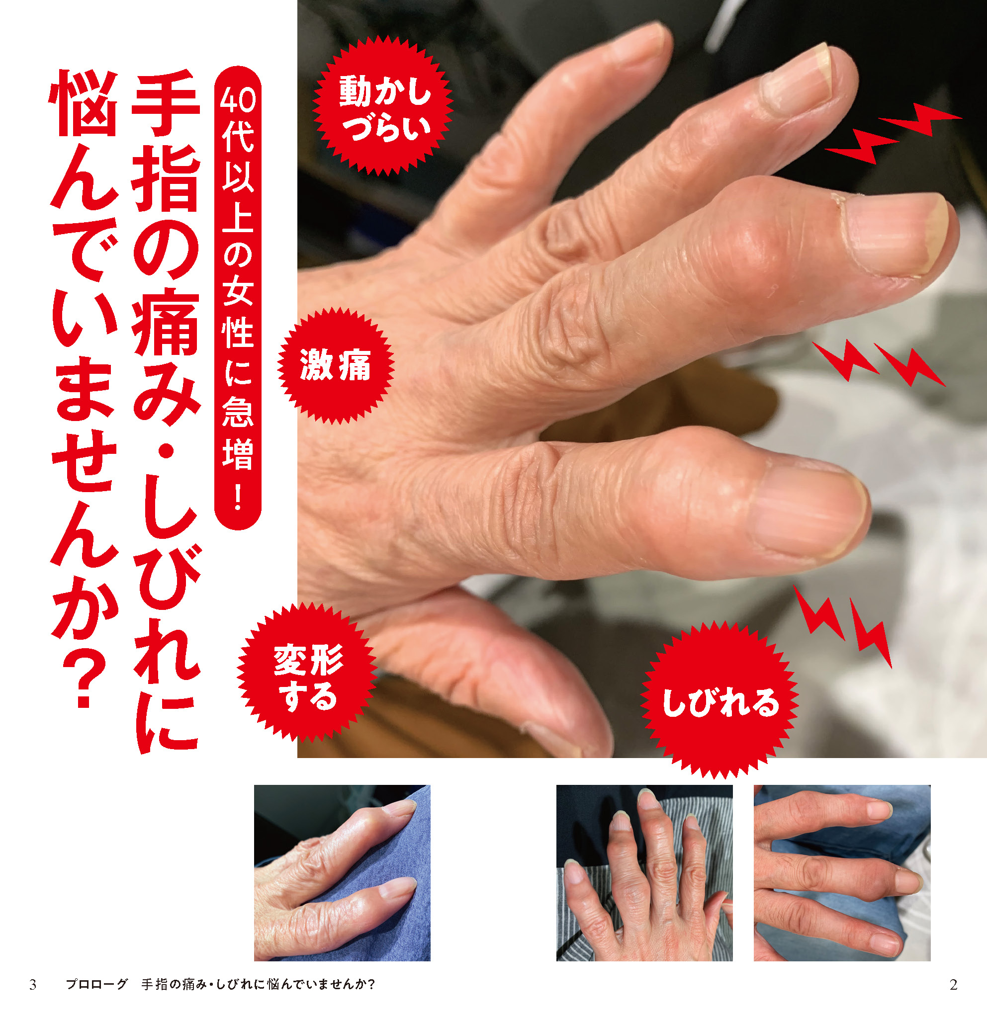 サムネイル画像1