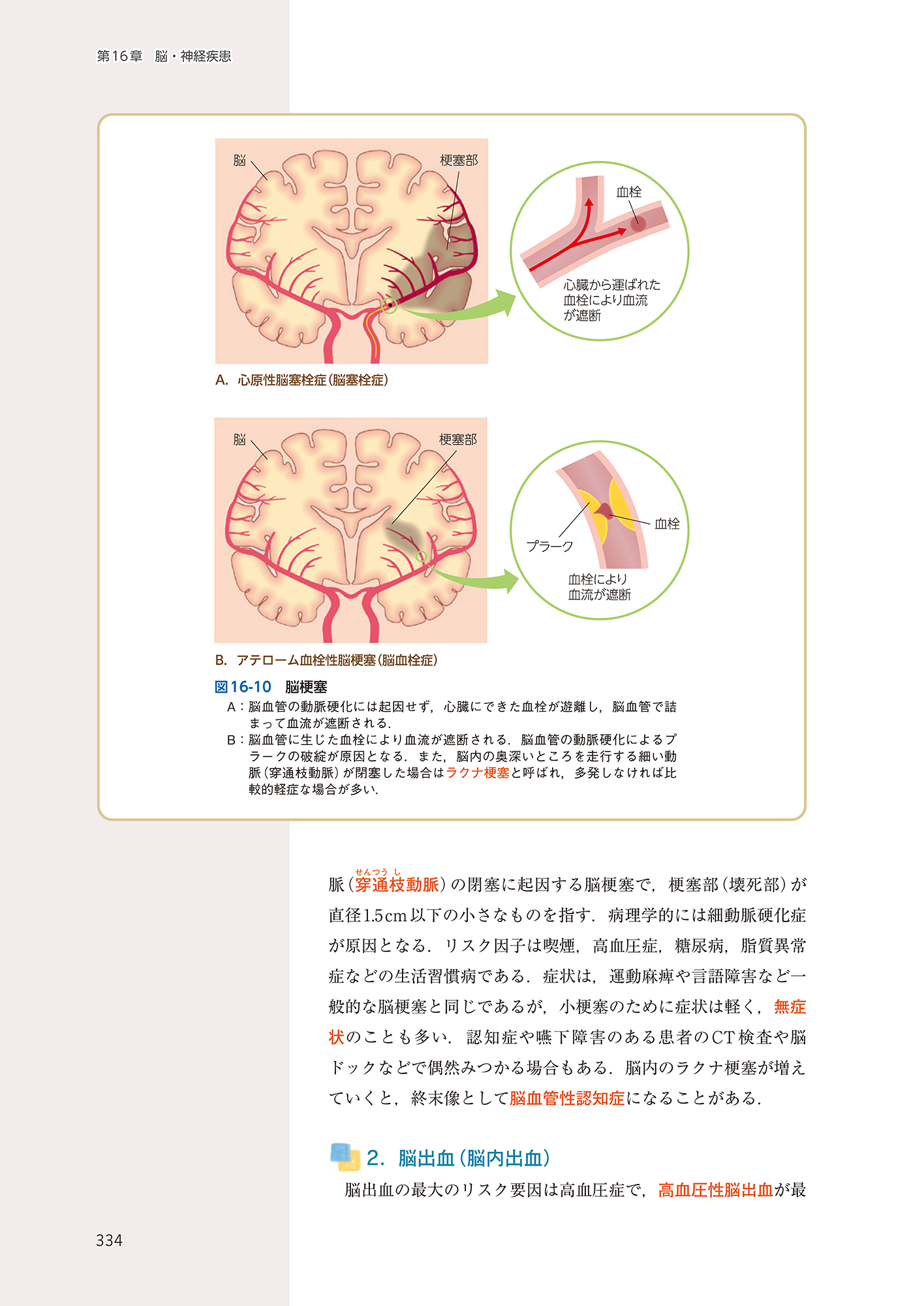 サムネイル画像4