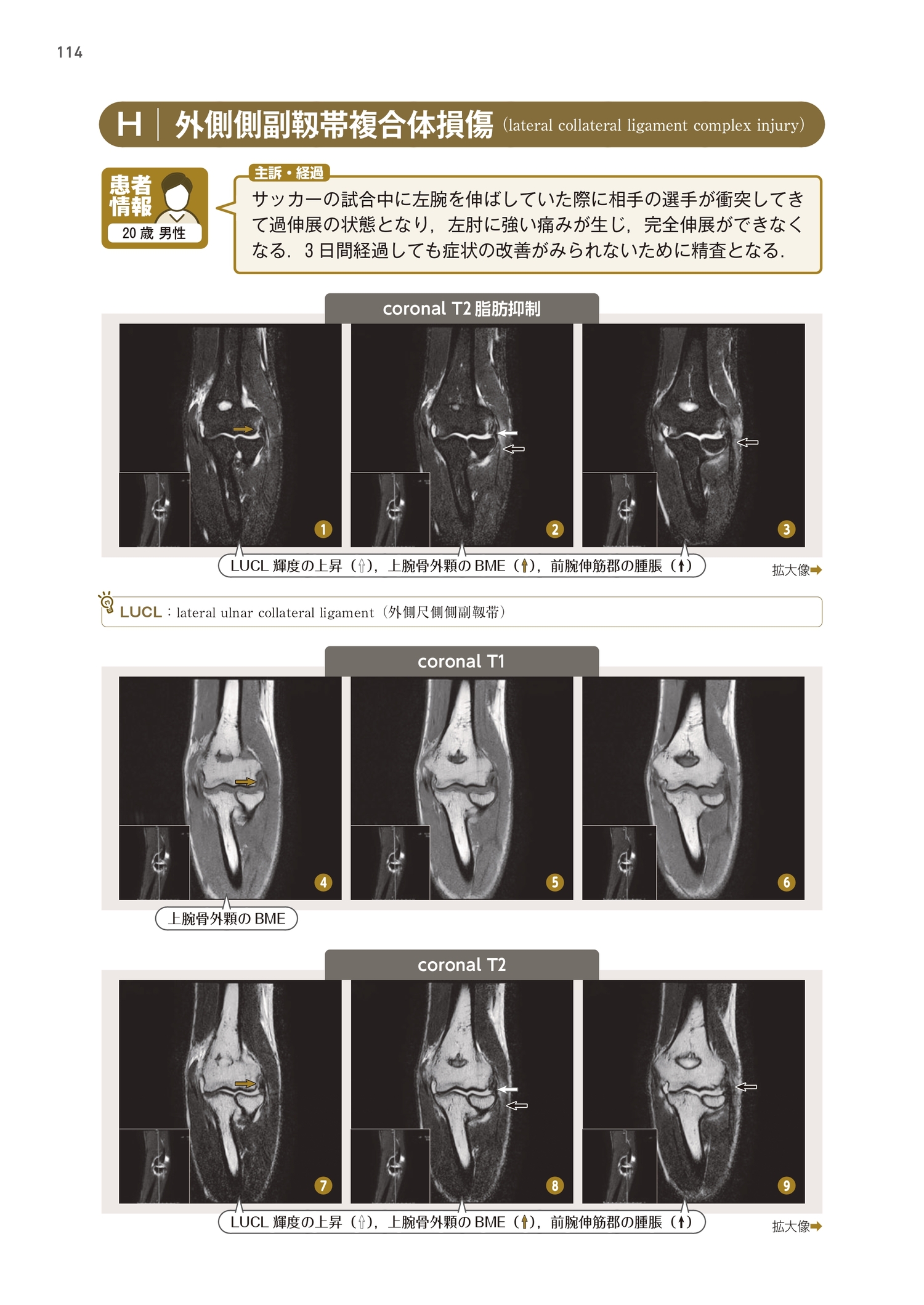 サムネイル画像5