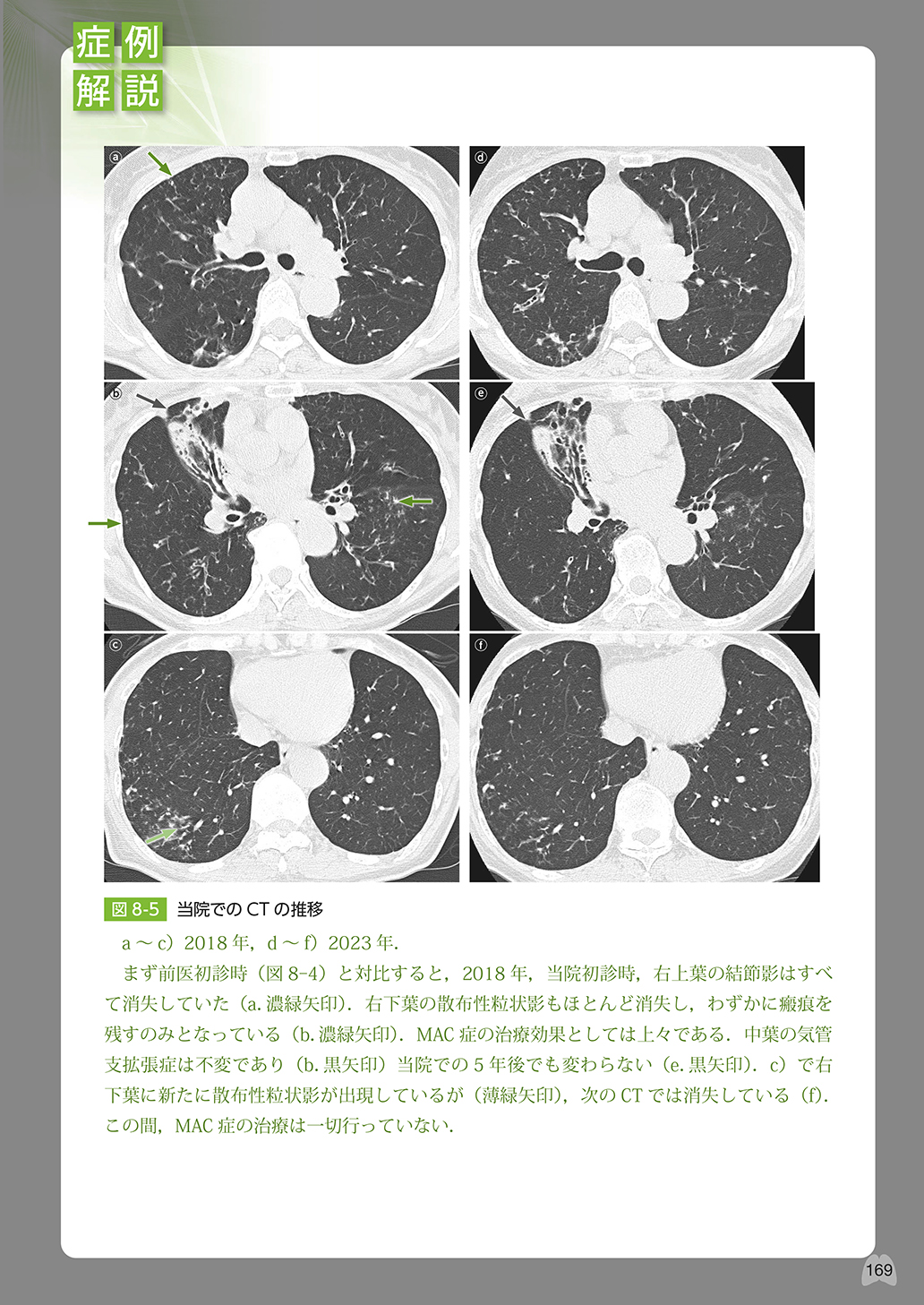 サムネイル画像4