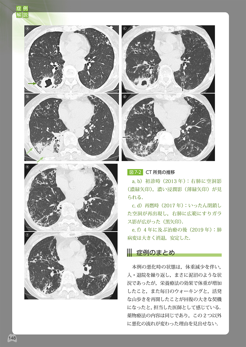 サムネイル画像9