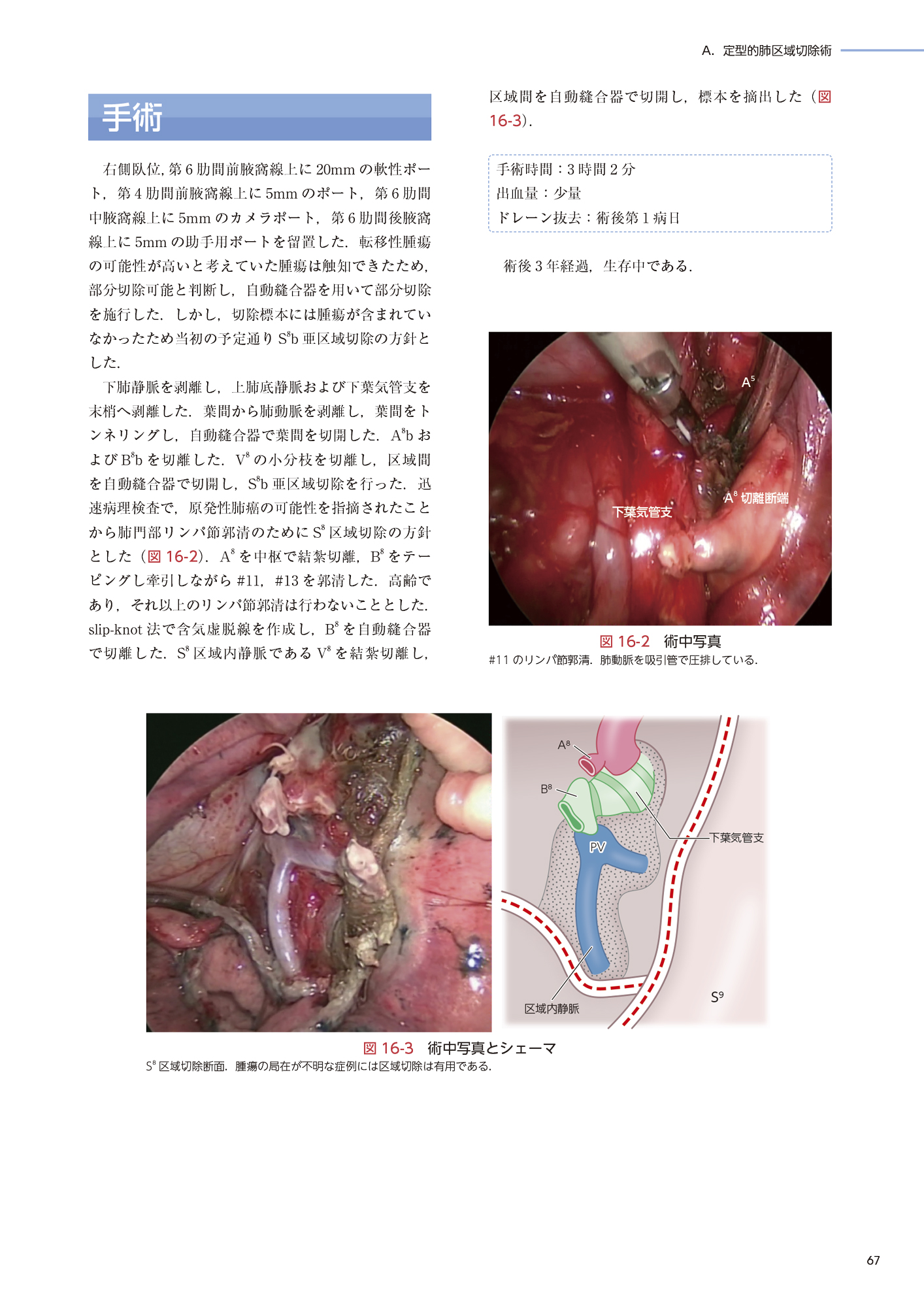 サムネイル画像4
