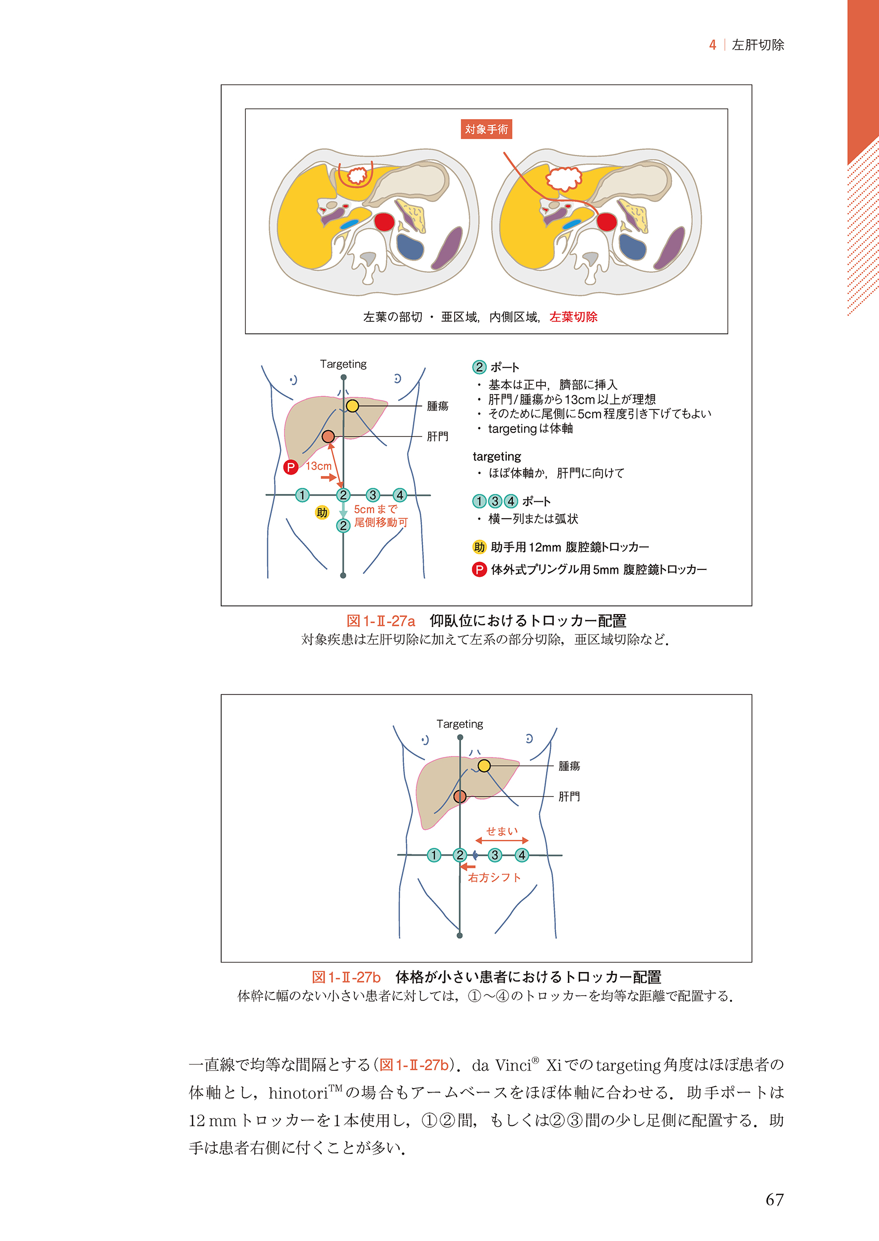 サムネイル画像2