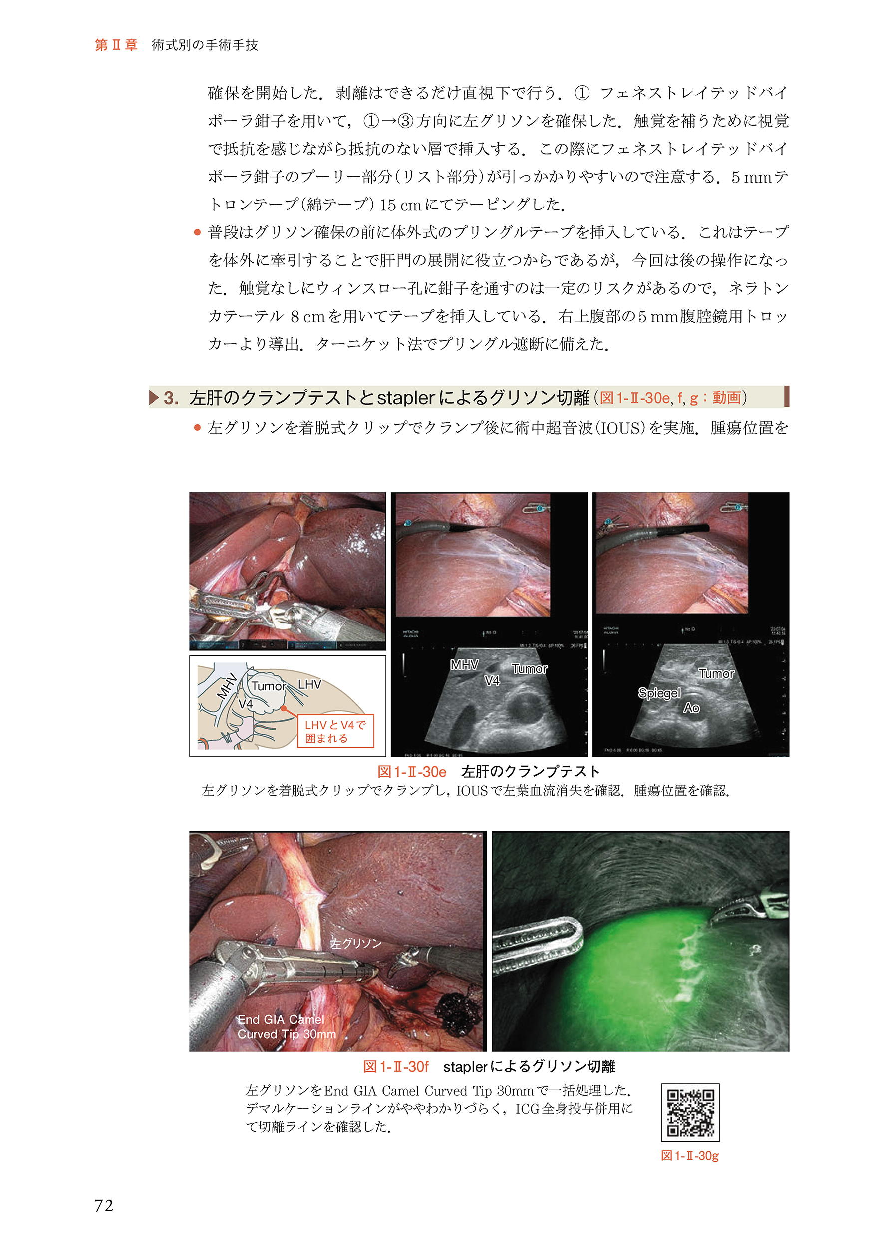 サムネイル画像3