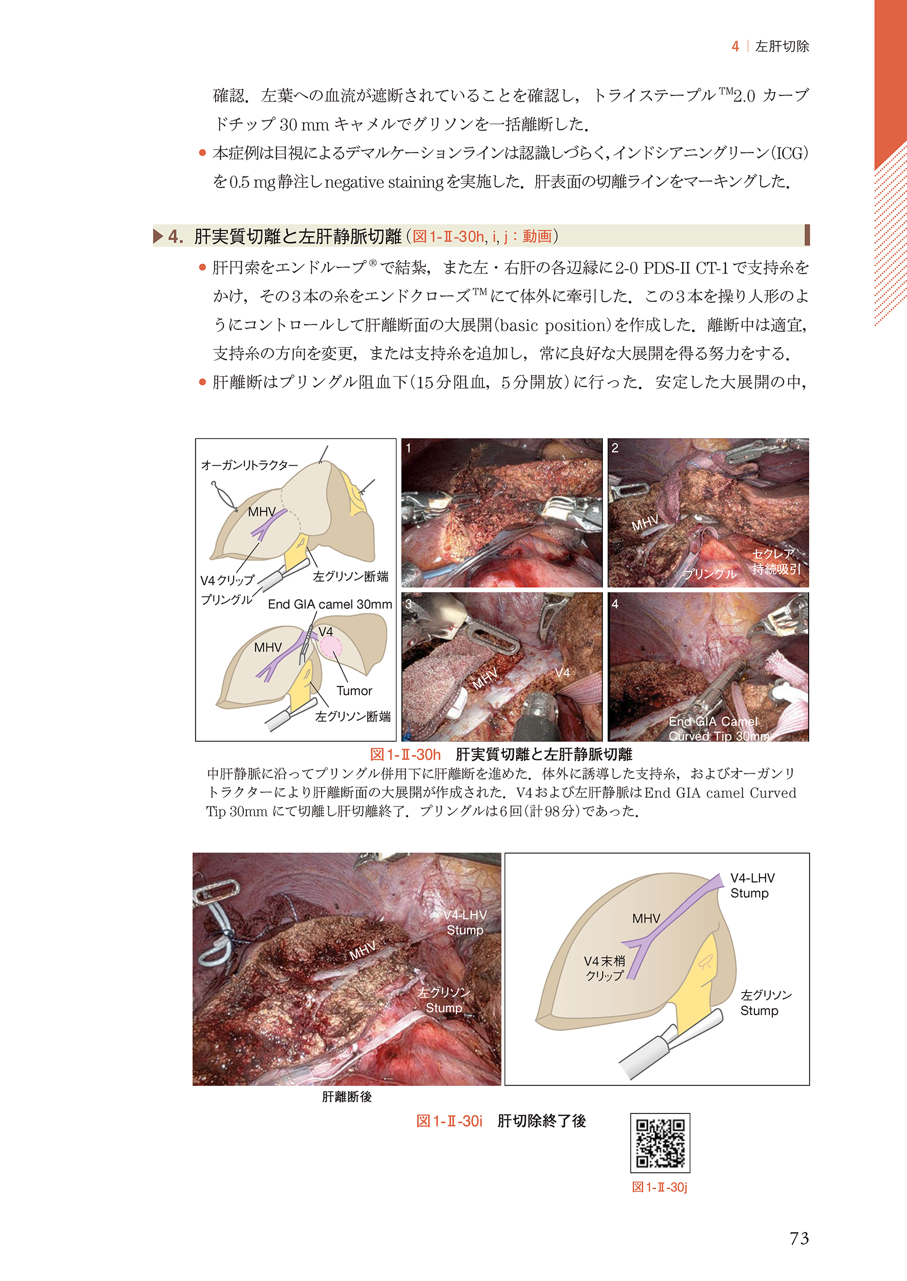 サムネイル画像4