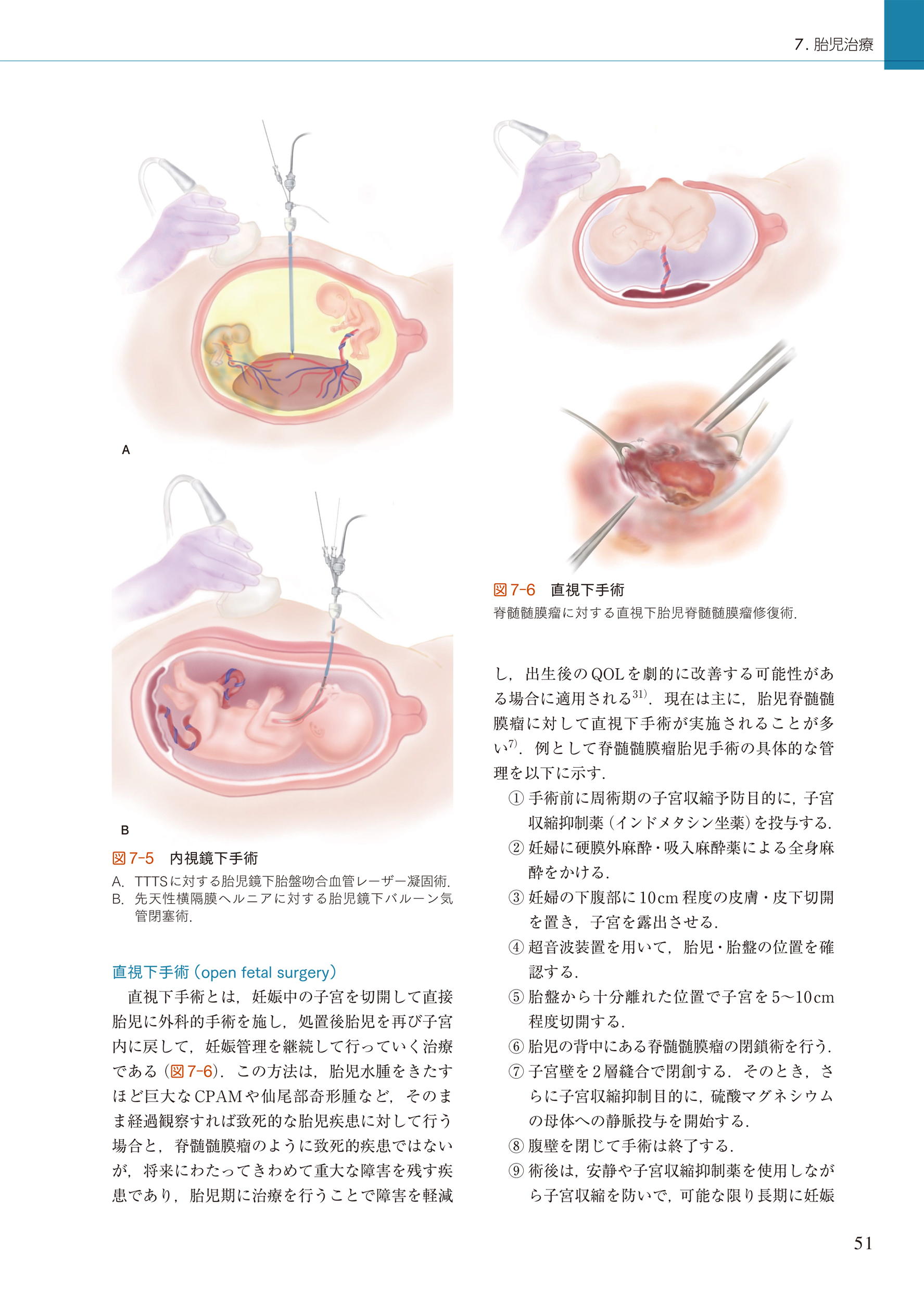 サムネイル画像2