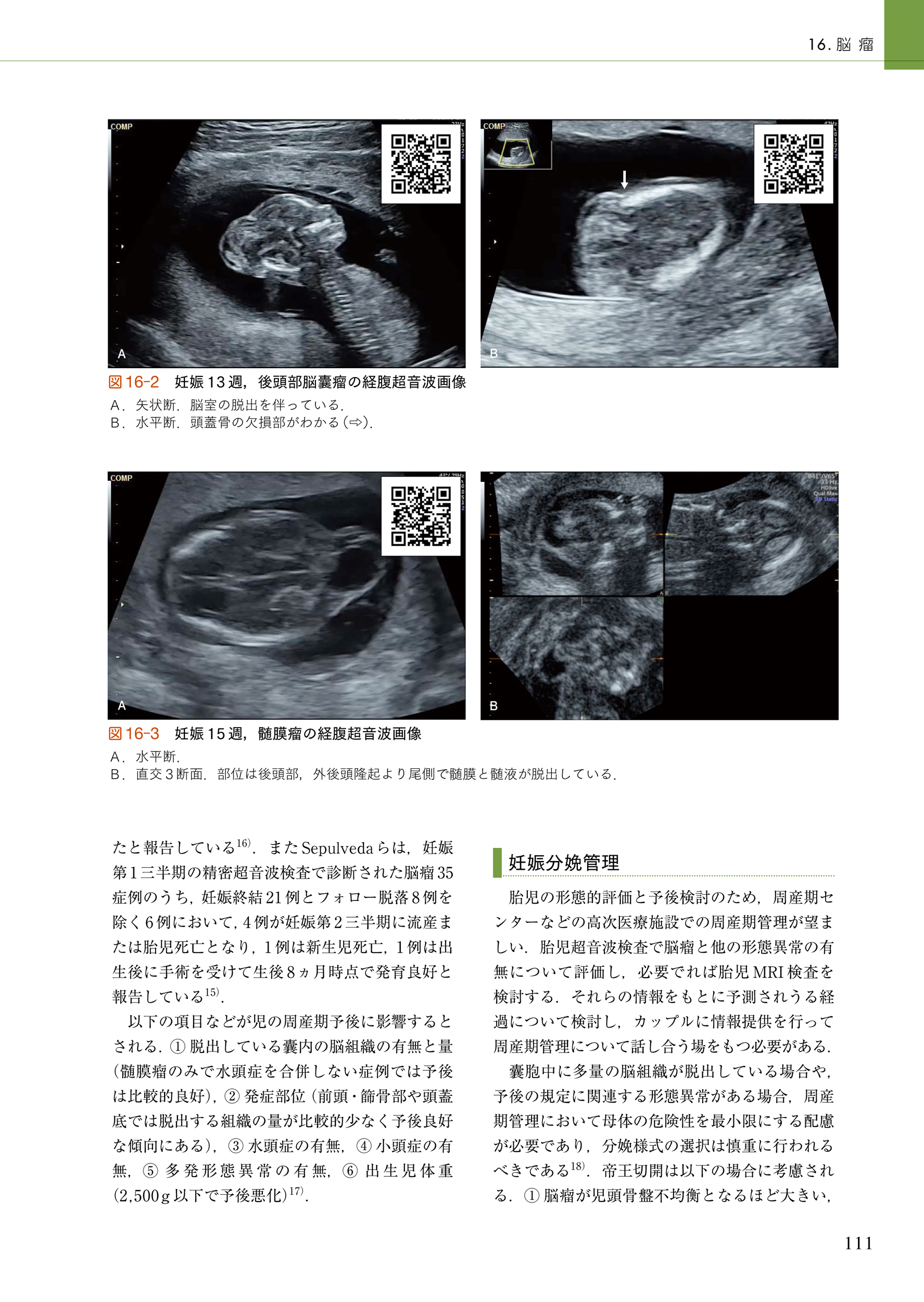 サムネイル画像4
