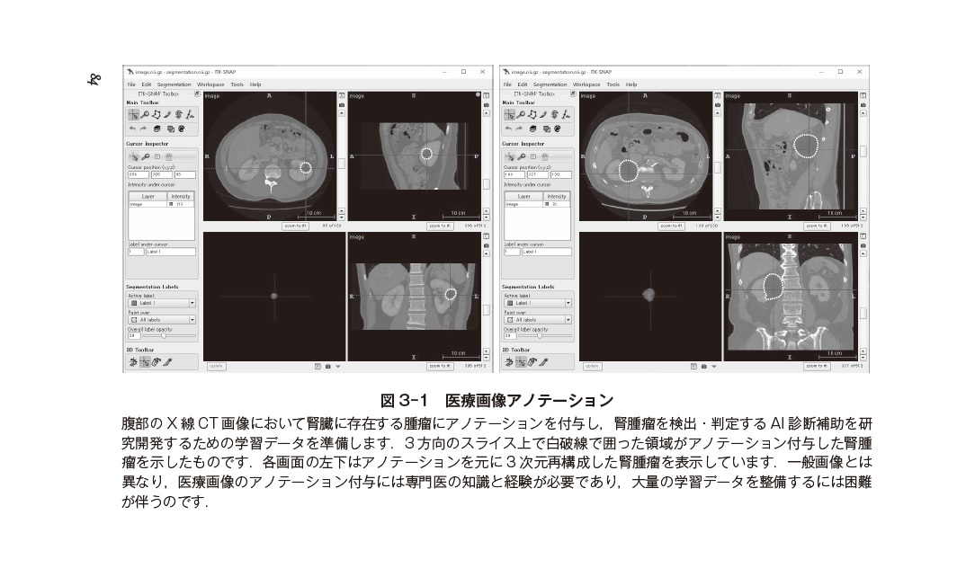 サムネイル画像2