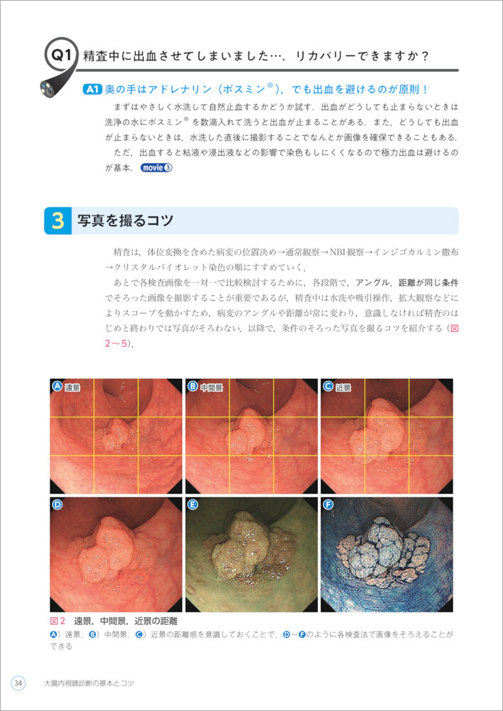 サムネイル画像2