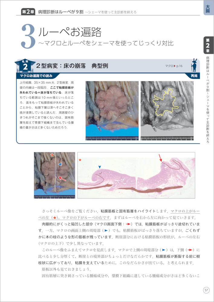 サムネイル画像3