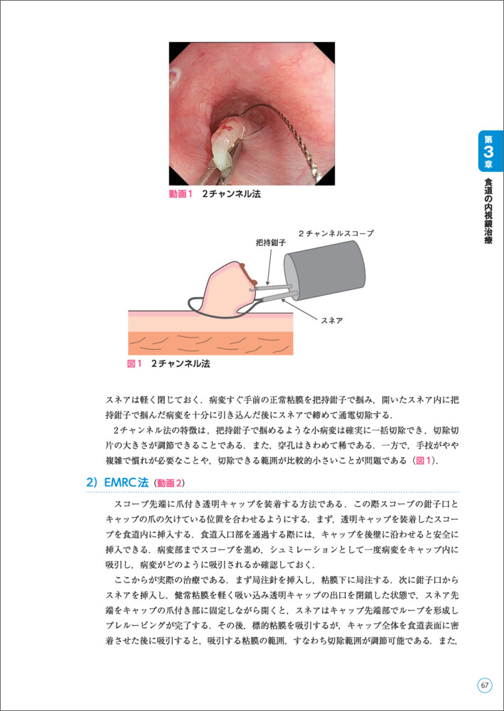 サムネイル画像3