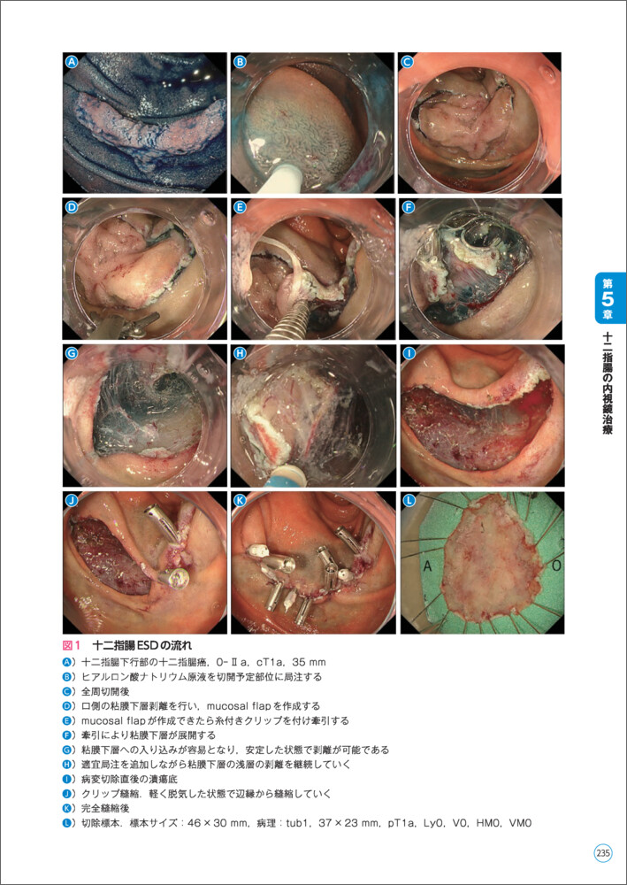 サムネイル画像5