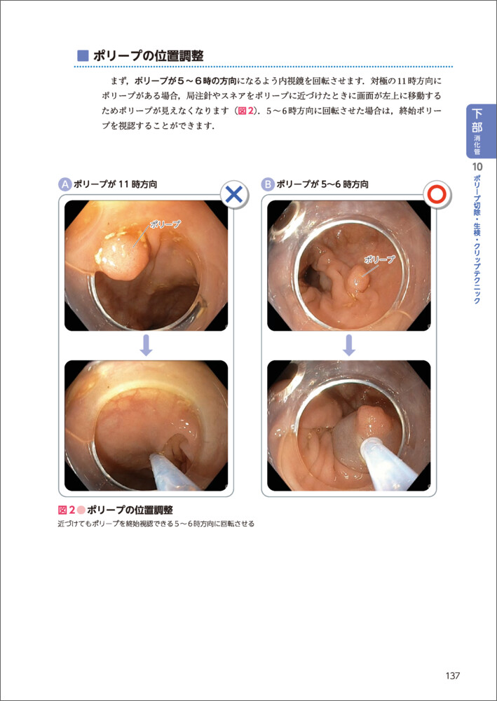 サムネイル画像5
