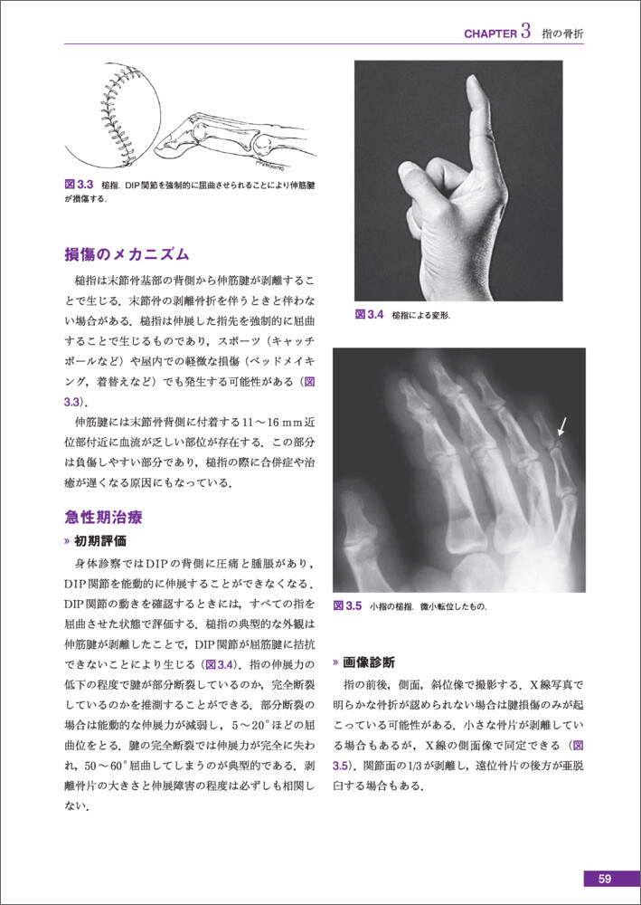 サムネイル画像4