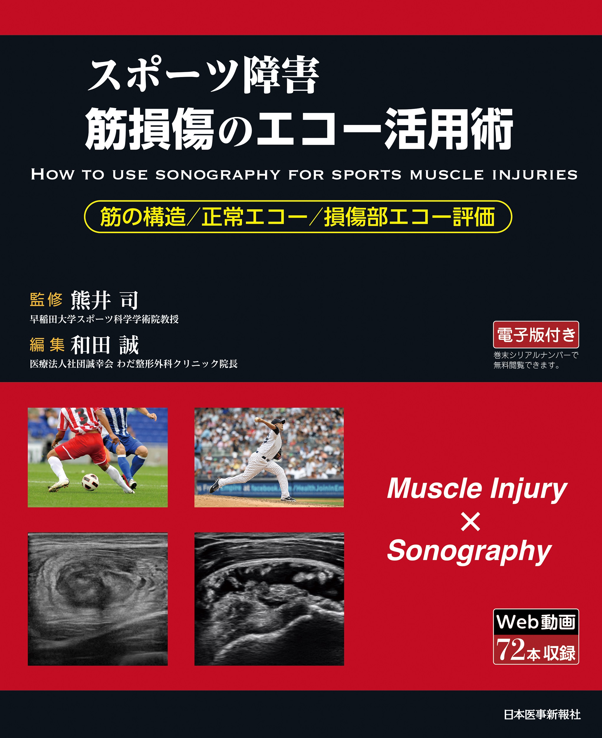 スポーツ障害＞筋損傷のエコー活用術 | 本の総合カタログBooks