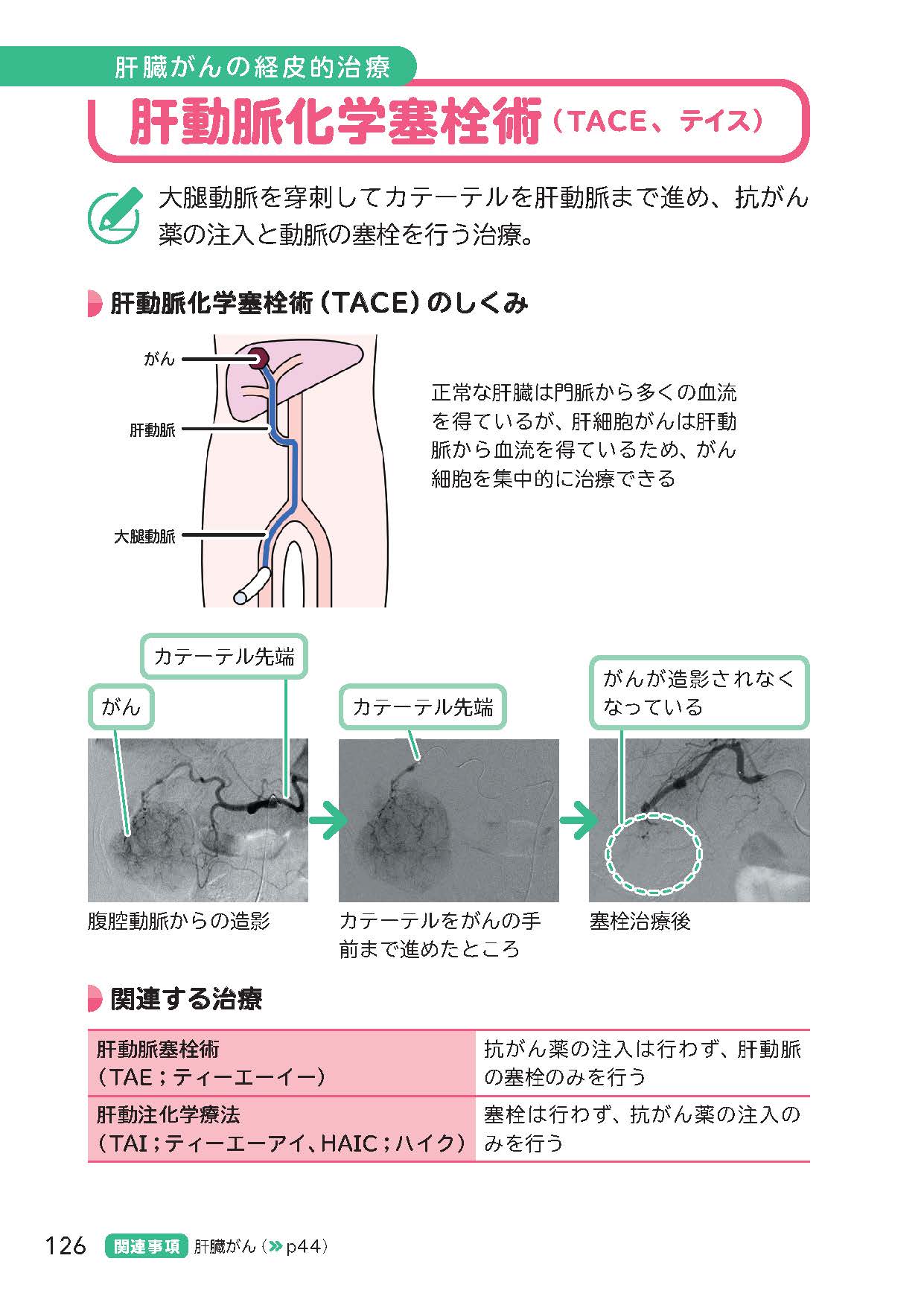 サムネイル画像4