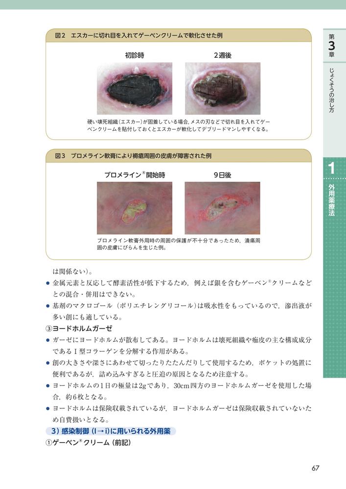 サムネイル画像4