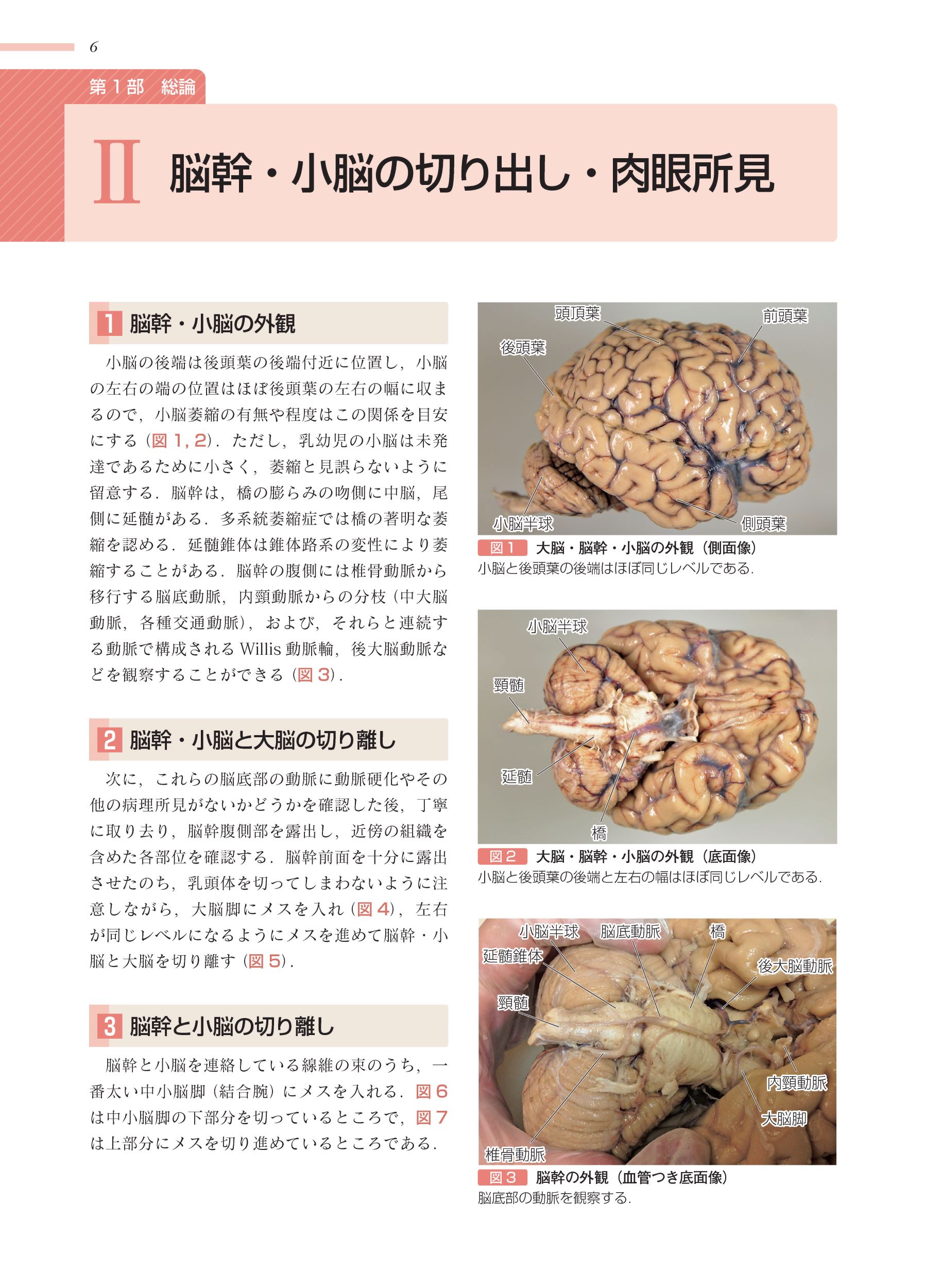 サムネイル画像2