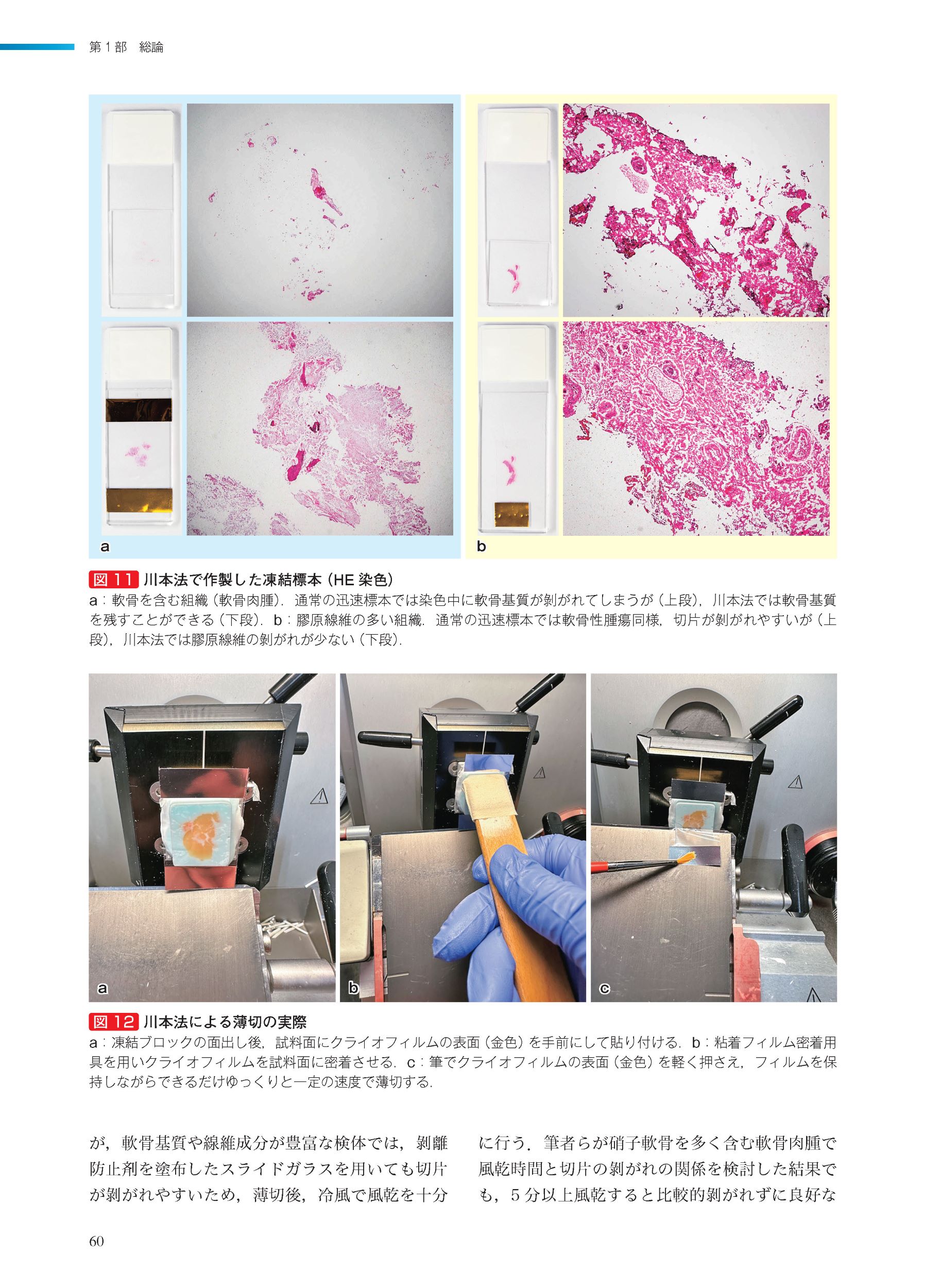 サムネイル画像3
