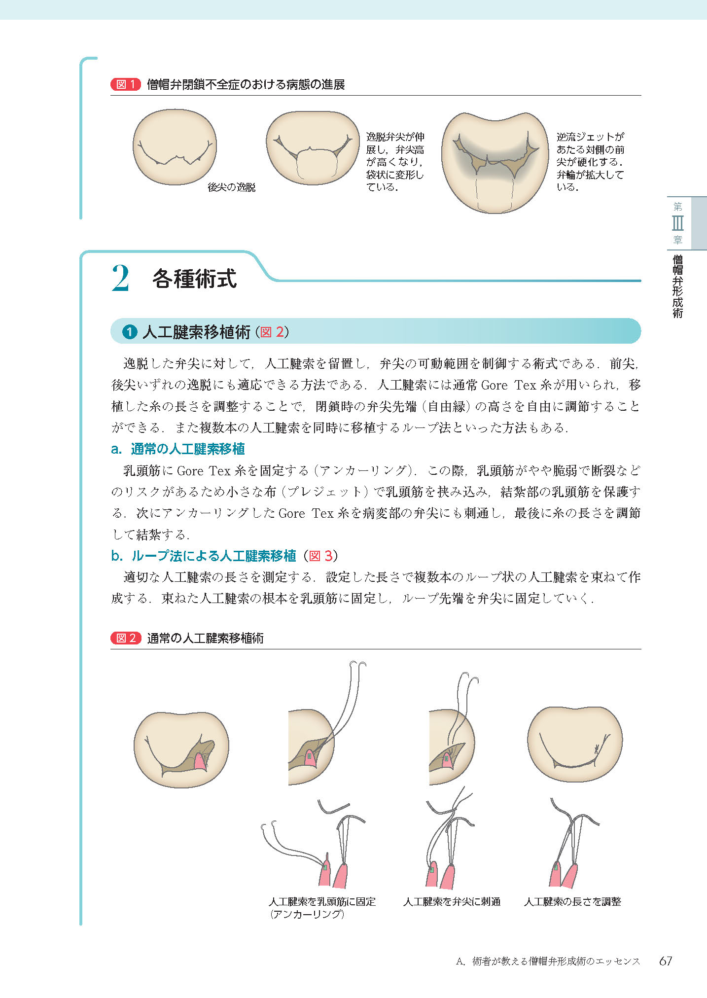 サムネイル画像3