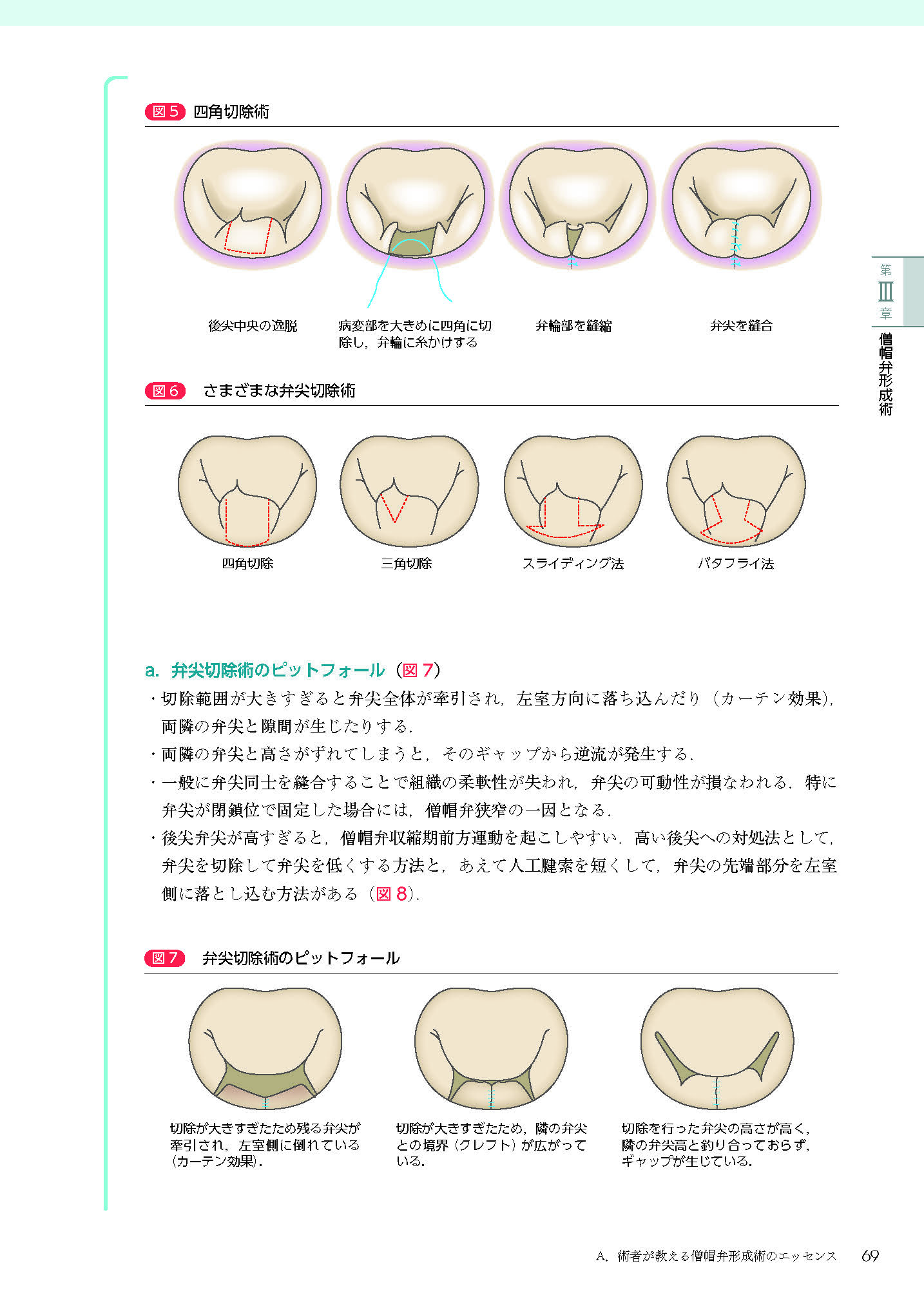 サムネイル画像5