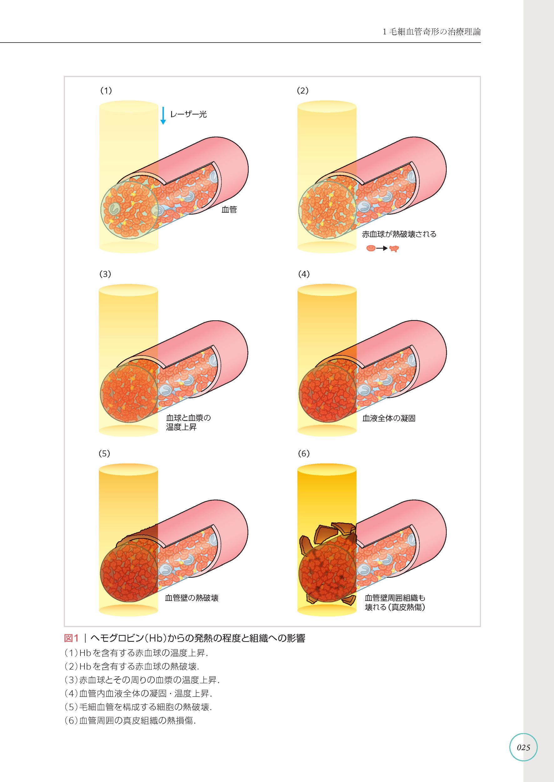 サムネイル画像2